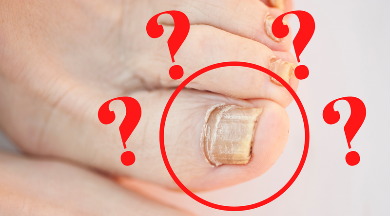 Why Are Your Toenails Thick? Read This.